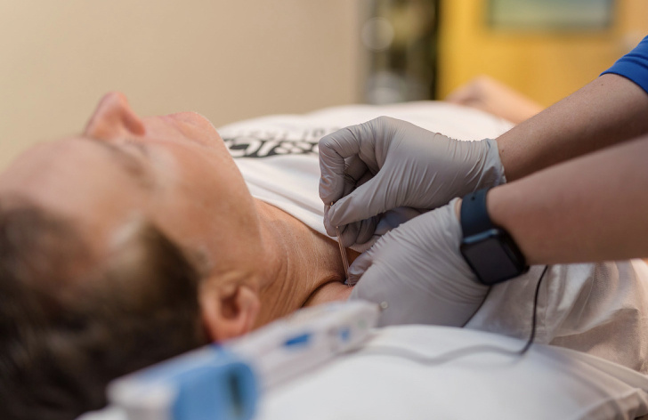 Physical Therapist Dry Needling Patient's Neck